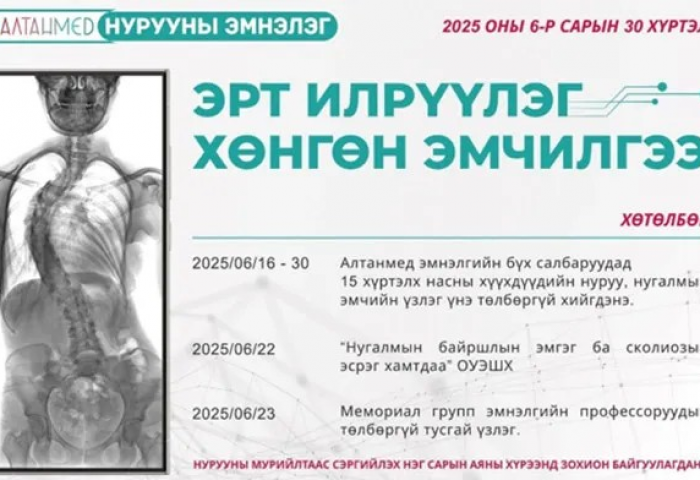 Өсвөр насны хүүхдэд илэрдэг сколиозын шинж тэмдгийг анзаарахгүй байснаар мурийлт нь ихэсдэг