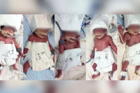 Хятадад таван ихэр хүүхэд төржээ