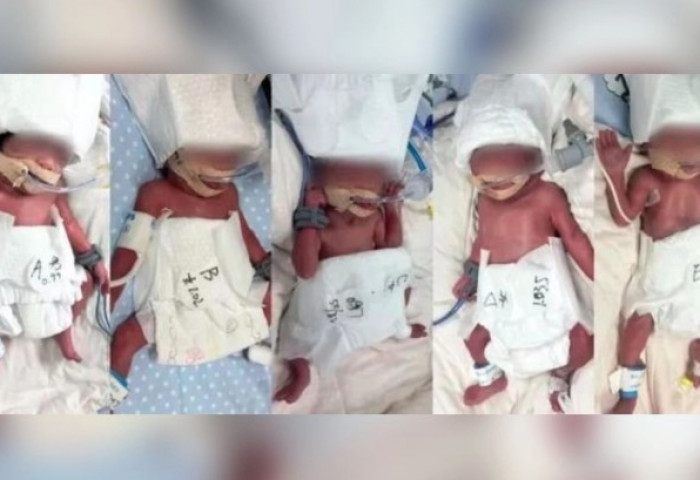 Хятадад таван ихэр хүүхэд төржээ