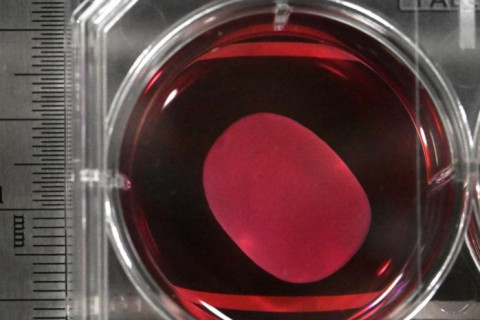 Паркинсоны өвчний эсрэг анхны бэлдмэлийг хэрэглэхийг зөвшөөрчээ