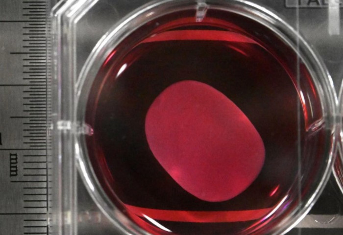 Паркинсоны өвчний эсрэг анхны бэлдмэлийг хэрэглэхийг зөвшөөрчээ